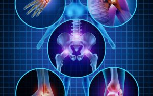 Paula Owens Osteoporosis Risk Factors 2