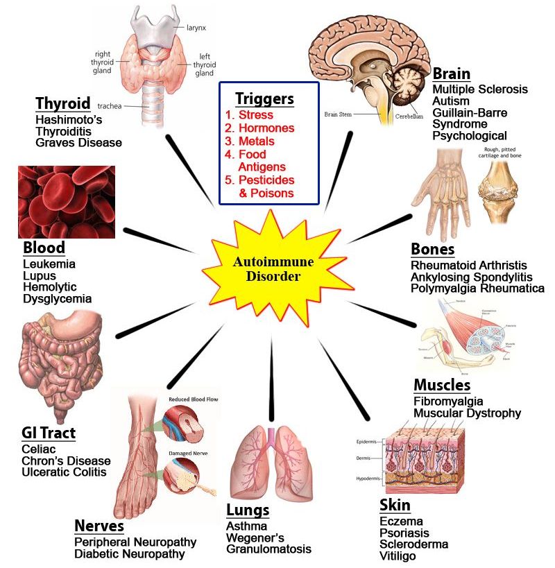 Heal, Prevent and Reverse Autoimmune Disease Naturally - Paula Owens