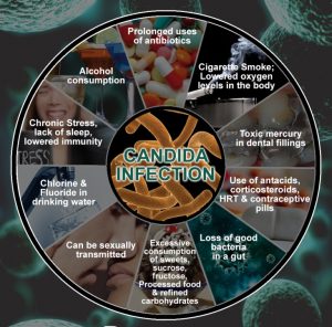 Paula Owens Candida Overgrowth: Is it Affecting Your Health? 2