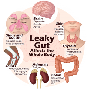 Leaky gut affects the whole body - Paula Owens, MS Holistic Nutritionist and Functional Health Practitioner