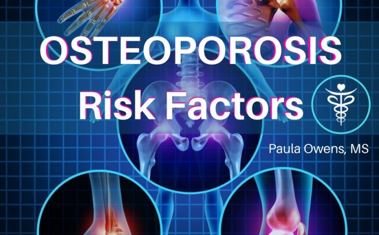Bone Loss And Osteoporosis Risk Factors Paula Owens Ms 