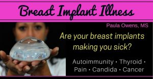 Paula Owens Breast Implant Illness: Are Your Breast Implants Making You Sick?