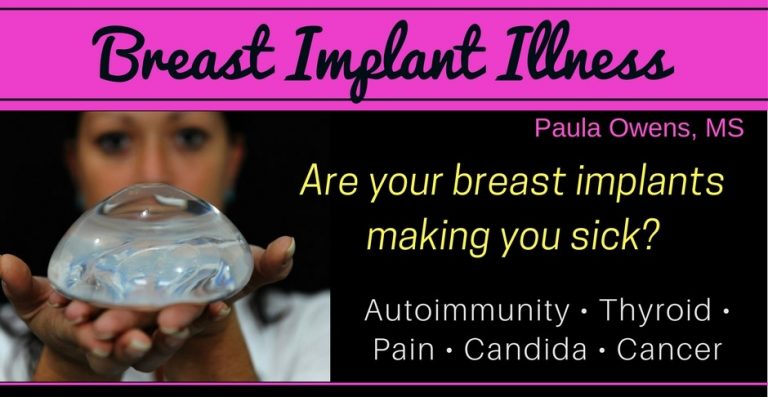 breast implant illness - Paula Owens