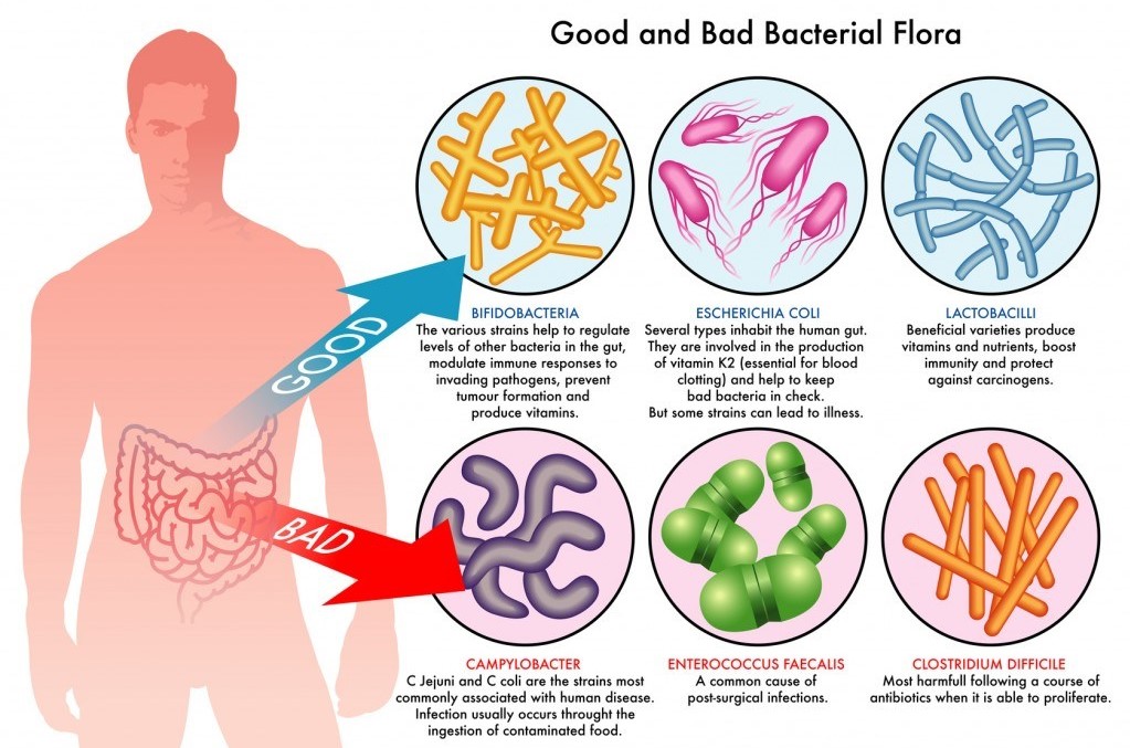 The Best Natural Antibiotics - Paula Owens, MS Holistic Nutritionist and Functional Medicine Practitioner