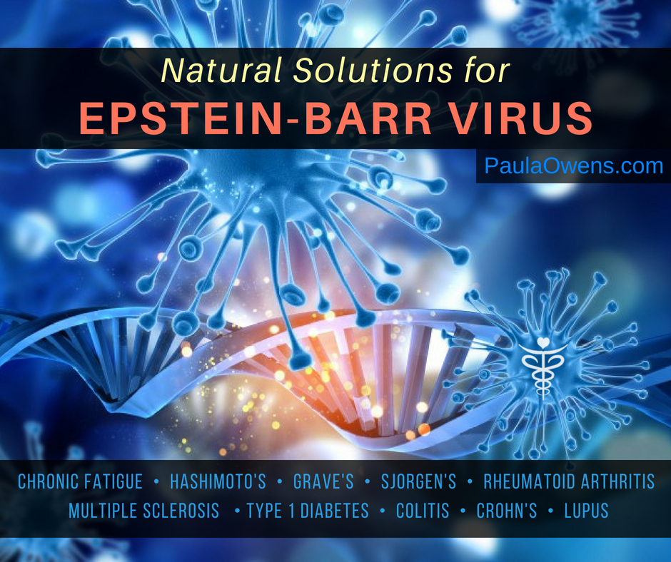 Epstein Barr Virus and Autoimmune Disease