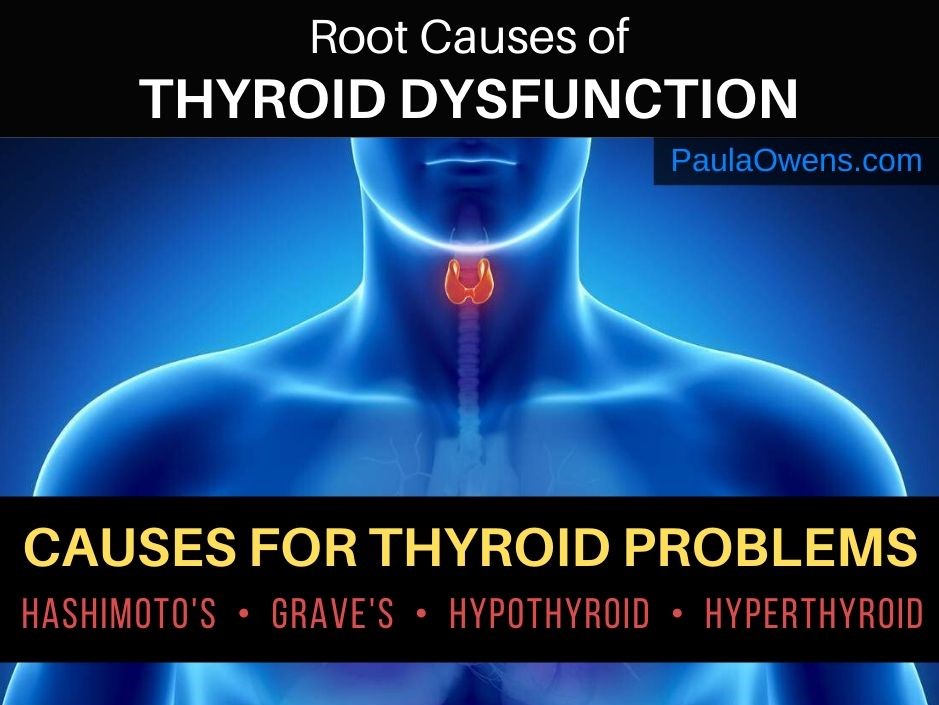 Thyroid Problems: Root Causes of Thyroid Dysfunction - Paula Owens, MS